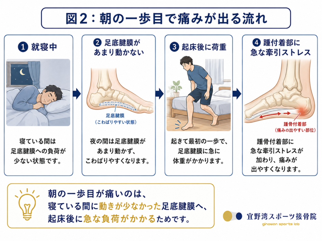 （図2：朝の一歩目で痛みが出る流れを示した図。就寝中→足底腱膜があまり動かない→起床後に荷重→踵付着部に急な牽引ストレス、という4コマまたはフローチャート形式）