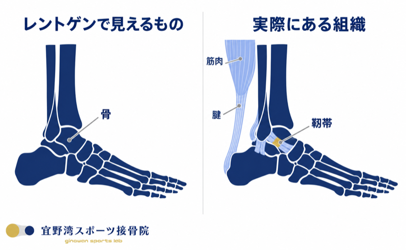 左はレントゲンで見えるもの（骨だけ）、右は実際にある組織（骨に加えて筋肉・腱・靭帯）の比較