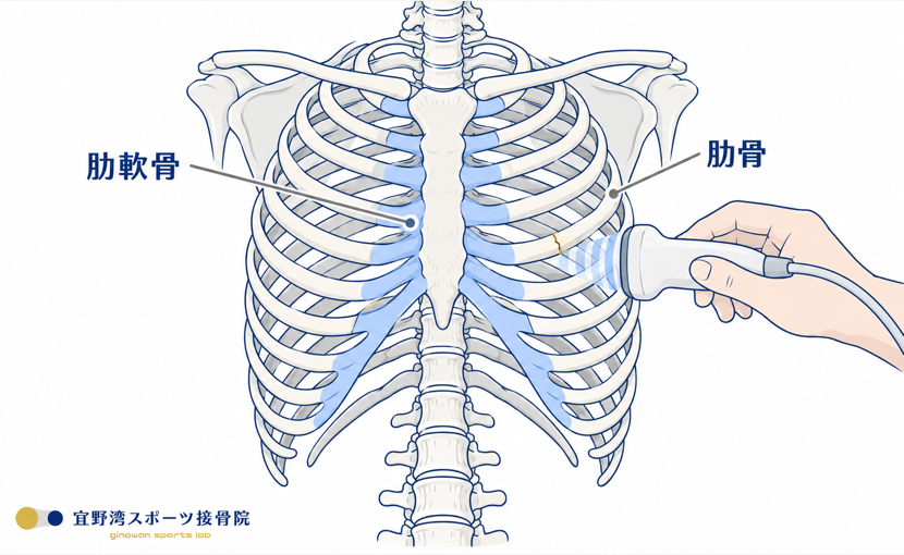 肋骨は体を取り巻くように曲がっており、前方は肋軟骨に移行する。痛む位置に直接プローブを当ててエコーで確かめる様子