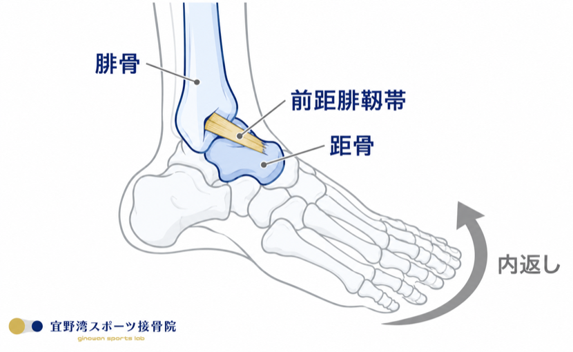 右足首を外側から見た図。腓骨の先端と距骨を結ぶ前距腓靭帯が、内返しの動きで引き伸ばされる様子