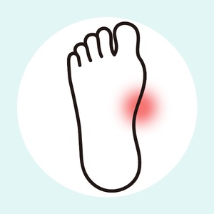 有痛性外脛骨（足の内側の出っ張りの痛み）
