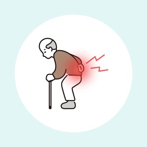 大腿骨大転子部痛症候群（お尻の横・股関節の外側の痛み）
