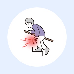 変形性膝関節症（中高年の膝の痛み）