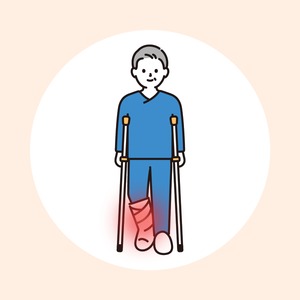 骨がつきにくいとき（骨癒合遅延・偽関節）