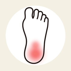 足底腱膜炎