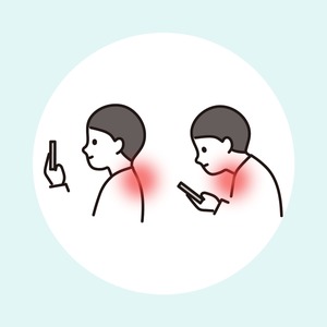 ストレートネック（スマホ首）と首・肩の痛み