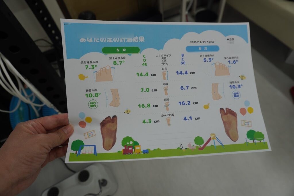 XPODの計測結果シート（足長・足幅・足囲・かかと幅・母趾小趾の角度・かかとの角度）